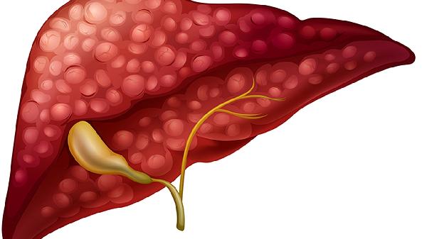 睡前90度倒竖腿的优点